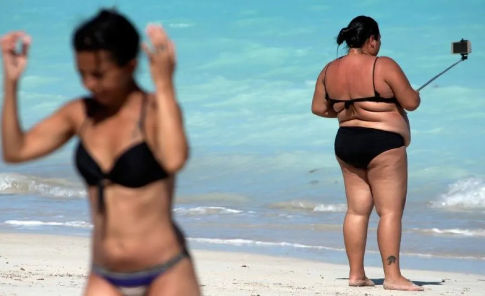 La OMS y especialistas buscan erradicar el estigma asociado a la obesidad para alentar las consultas