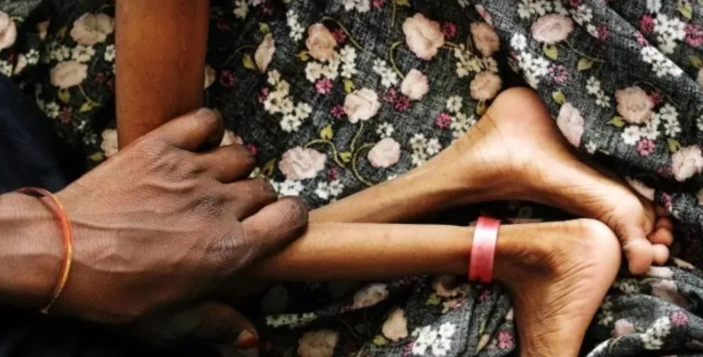 Unicef alerta sobre efectos "irreversibles" en la desnutrición de mujeres y niñas