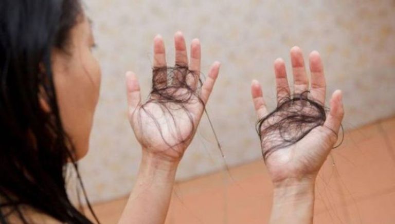 Aumentan las consultas médicas de personas cada vez más jóvenes por caída de cabello